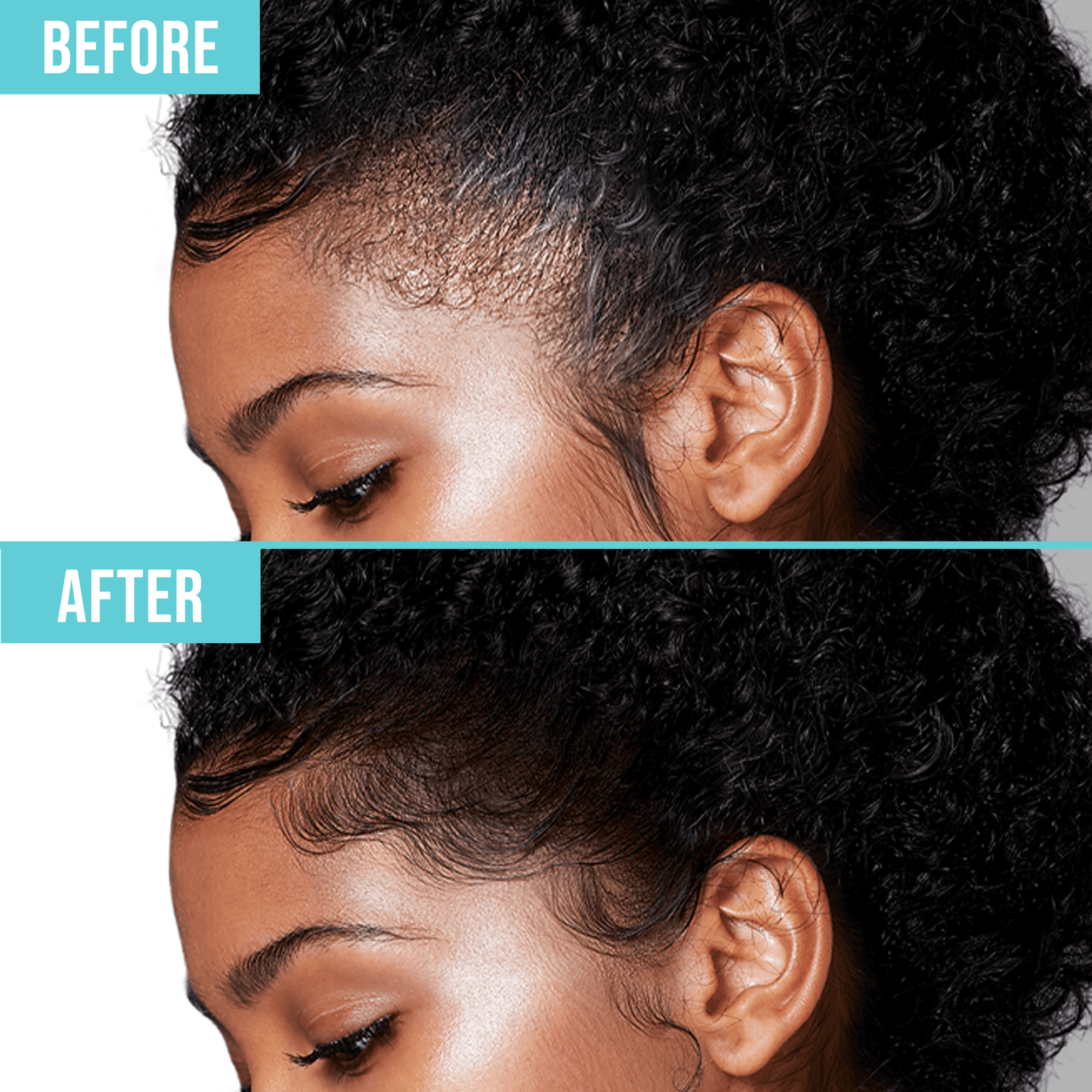 Side profile close-up of a woman’s hairline before and after using edge fixer gel, showing sleek, smooth edges with the text “BEFORE” and “AFTER.”