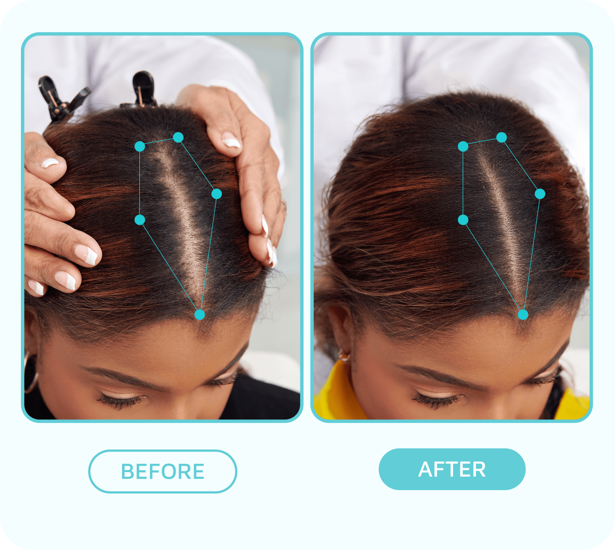 Top-down views of a woman’s scalp showing hair thinning before and visibly fuller hair after using the scalp fixer serum, with labeled before and after sections.