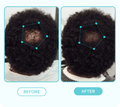Side-by-side photos show the back of a person’s head with curly black hair, highlighting a scalp spot before and after treatment, labeled "Before" and "After."