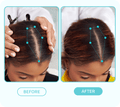 Top-down views of a woman’s scalp showing hair thinning before and visibly fuller hair after using the scalp fixer serum, with labeled before and after sections.